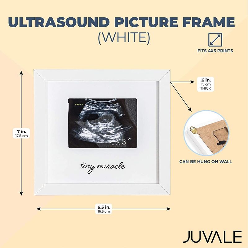 White Sonogram Keepsake Frame for 4 x 3 Ultrasound Photos (7 x 6.5 Inches)