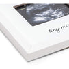 White Sonogram Keepsake Frame for 4 x 3 Ultrasound Photos (7 x 6.5 Inches)