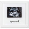 White Sonogram Keepsake Frame for 4 x 3 Ultrasound Photos (7 x 6.5 Inches)